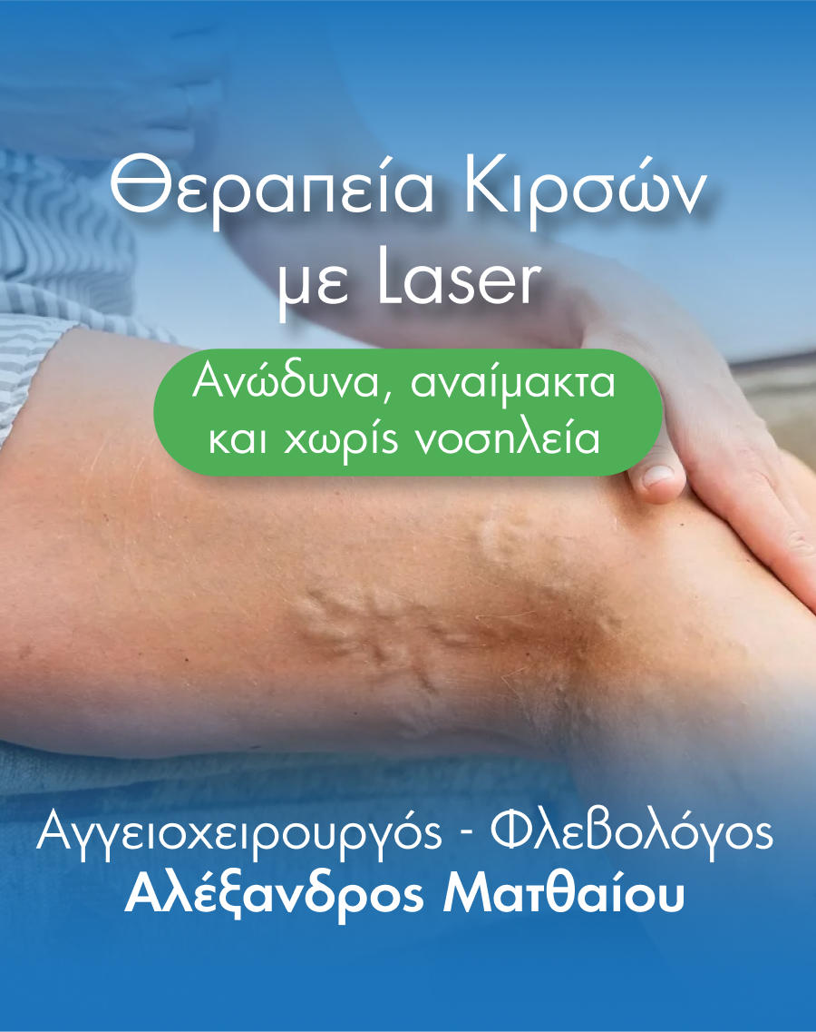 αφαίρεση κιρσών με laser mobile αφαίρεση κιρσών με laser